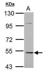 Anti-KLHDC5 antibody used in Western Blot (WB). GTX120046