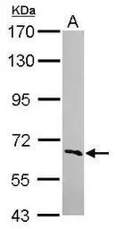Anti-FBXW5 antibody [N2C2], Internal used in Western Blot (WB). GTX120049