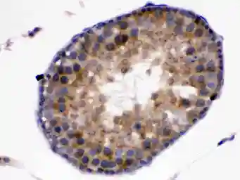 Anti-Kallikrein 5 antibody used in IHC (Paraffin sections) (IHC-P). GTX12009