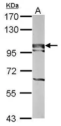 Anti-BOP1 antibody [N3C3] used in Western Blot (WB). GTX120120