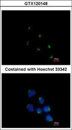 Anti-GCC1 antibody [C1C3] used in Immunocytochemistry/ Immunofluorescence (ICC/IF). GTX120148