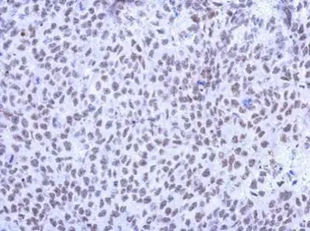 Anti-KLHL13 antibody [N3C2], Internal used in IHC (Paraffin sections) (IHC-P). GTX120173