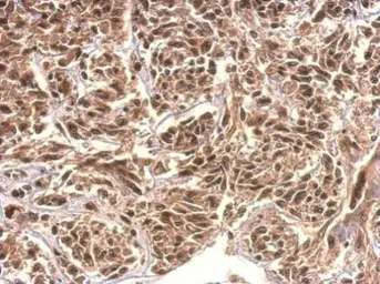 Anti-KIAA0323 antibody [C2C3], C-term used in IHC (Paraffin sections) (IHC-P). GTX120182
