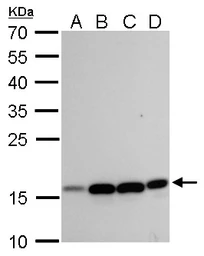 Anti-MRPL42 antibody used in Western Blot (WB). GTX120260
