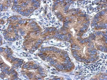 Anti-CCDC70 antibody [N1C3] used in IHC (Paraffin sections) (IHC-P). GTX120333