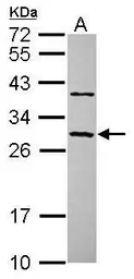 Anti-CCDC70 antibody [N1C3] used in Western Blot (WB). GTX120333