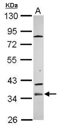 Anti-ZP1 antibody [C1C3] used in Western Blot (WB). GTX120384