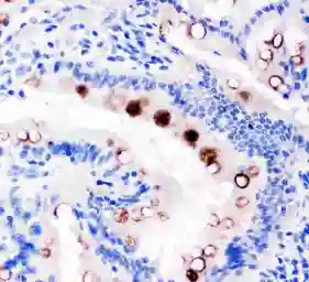 Anti-TFF1 antibody used in IHC (Paraffin sections) (IHC-P). GTX12040