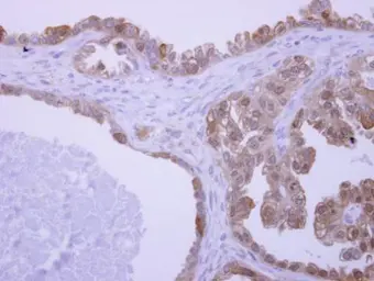 Anti-UBAC1 antibody [N2C3] used in IHC (Paraffin sections) (IHC-P). GTX120460
