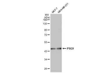 Anti-PSG9 antibody [C1C3] used in Western Blot (WB). GTX120479