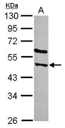 Anti-STAMBPL1 antibody [N3C3] used in Western Blot (WB). GTX120491