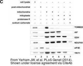 Anti-TRIT1 antibody [N1C1] used in Western Blot (WB). GTX120508