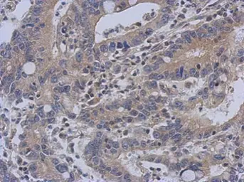 Anti-C14orf21 antibody used in IHC (Paraffin sections) (IHC-P). GTX120536