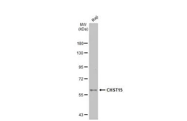 Anti-CHST15 antibody [N3C2], Internal used in Western Blot (WB). GTX120568