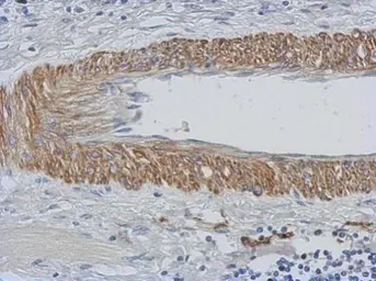 Anti-CHST15 antibody [N3C2], Internal used in IHC (Paraffin sections) (IHC-P). GTX120568
