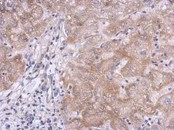Anti-KLHL21 antibody [C1C3] used in IHC (Paraffin sections) (IHC-P). GTX120580