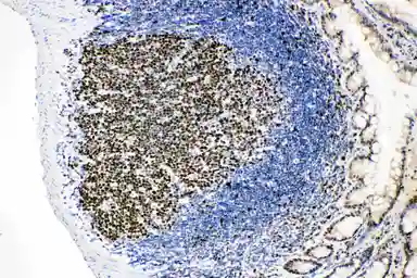 Anti-MCM2 antibody used in IHC (Paraffin sections) (IHC-P). GTX12059
