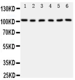 Anti-MCM2 antibody used in Western Blot (WB). GTX12059