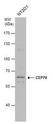 Anti-CEP70 antibody used in Western Blot (WB). GTX120594