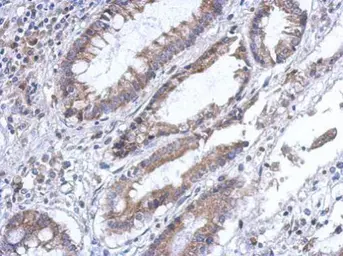 Anti-PLA2G4F antibody [C2C3], C-term used in IHC (Paraffin sections) (IHC-P). GTX120597
