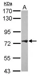 Anti-PLA2G4F antibody [C2C3], C-term used in Western Blot (WB). GTX120597