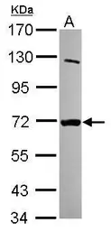 Anti-MTMR8 antibody [C1C3] used in Western Blot (WB). GTX120628