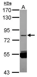 Anti-ZNF280C antibody [N2C1], Internal used in Western Blot (WB). GTX120643