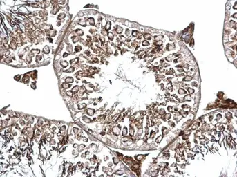 Anti-BICD2 antibody used in IHC (Paraffin sections) (IHC-P). GTX120683