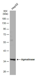 Anti-Agmatinase antibody used in Western Blot (WB). GTX120707