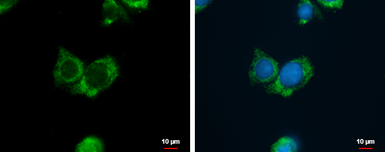 Anti-Agmatinase antibody used in Immunocytochemistry/ Immunofluorescence (ICC/IF). GTX120707