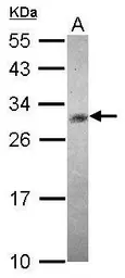 Anti-CHAC1 antibody [N1C3] used in Western Blot (WB). GTX120775