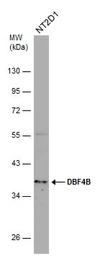 Anti-DBF4B antibody used in Western Blot (WB). GTX120796