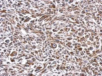 Anti-ERLIN1 antibody used in IHC (Paraffin sections) (IHC-P). GTX120815
