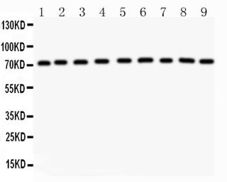 Anti-Growth hormone Receptor antibody used in Western Blot (WB). GTX12082