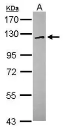 Anti-FAM120A antibody used in Western Blot (WB). GTX120824