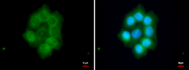 Anti-FAM46C antibody used in Immunocytochemistry/ Immunofluorescence (ICC/IF). GTX120834