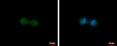 Anti-MKLP1 antibody [N1N2], N-term used in Immunocytochemistry/ Immunofluorescence (ICC/IF). GTX120875