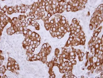 Anti-Keratin 36 antibody used in IHC (Paraffin sections) (IHC-P). GTX120881