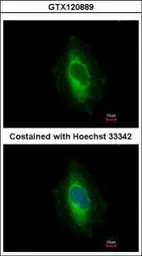 Anti-EPLIN antibody used in Immunocytochemistry/ Immunofluorescence (ICC/IF). GTX120889