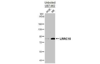 Anti-LRRC15 antibody [N1N3] used in Western Blot (WB). GTX120895