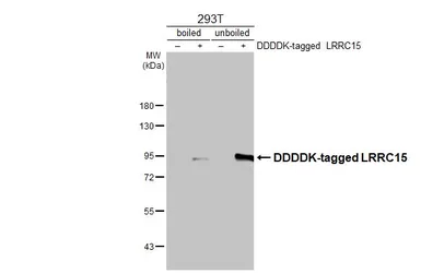 Anti-LRRC15 antibody [N1N3] used in Western Blot (WB). GTX120895
