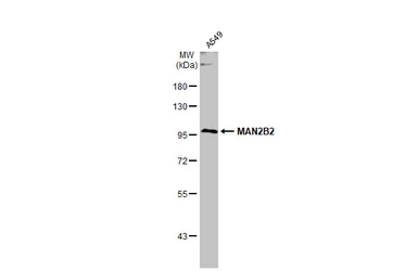 Anti-MAN2B2 antibody [C1C3] used in Western Blot (WB). GTX120906