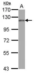 Anti-MAN2B2 antibody [C1C3] used in Western Blot (WB). GTX120906