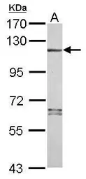 Anti-NLRP7 antibody [N3C2], Internal used in Western Blot (WB). GTX120931