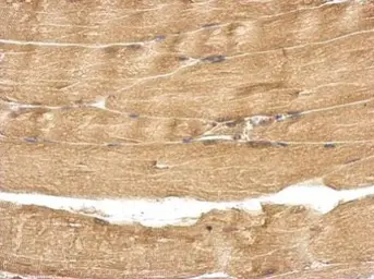 Anti-TBC1D15 antibody used in IHC (Paraffin sections) (IHC-P). GTX121081