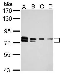 Anti-TBC1D15 antibody used in Western Blot (WB). GTX121081