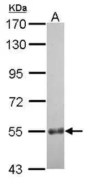 Anti-CCDC7 antibody [N1C1] used in Western Blot (WB). GTX121203
