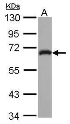 Anti-GEFT antibody used in Western Blot (WB). GTX121237