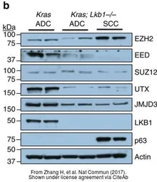 Anti-KDM6A antibody [N2C1], Internal used in Western Blot (WB). GTX121246