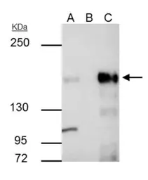 Anti-KDM6A antibody [N2C1], Internal used in Immunoprecipitation (IP). GTX121246